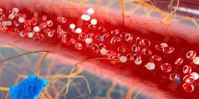 Myeloma: Peningkatan Abnormal Sel Plasma Darah • Deherba.com